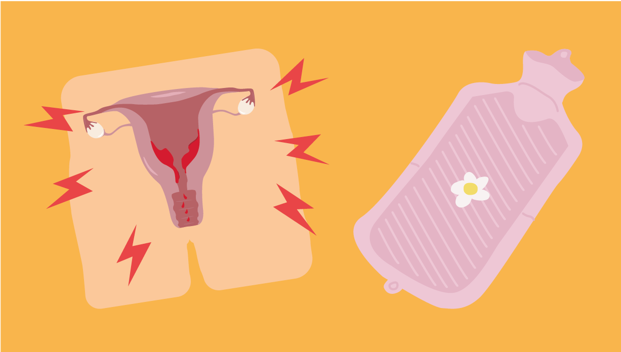 ¿Qué es el síndrome premenstrual (SPM)?